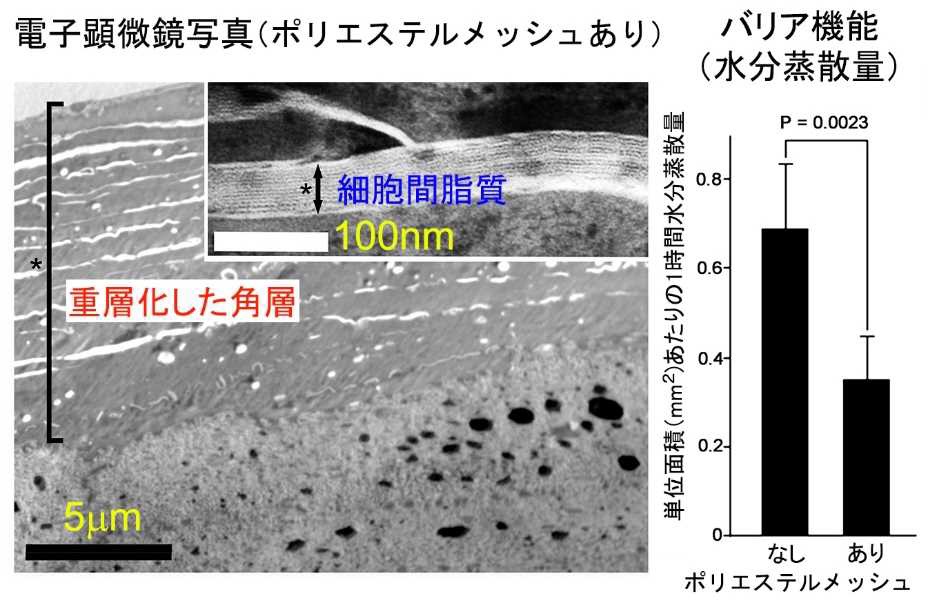 数理モデルを用いて、ヒト皮膚並みの厚みを持つ3次元培養表皮を構築:医療技術ニュース - MONOist