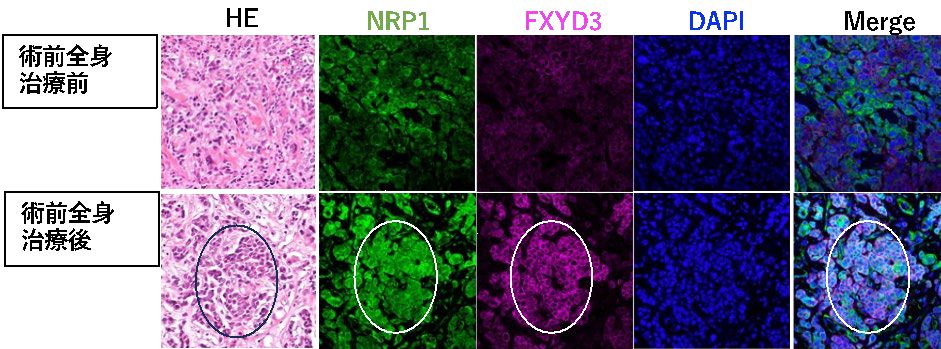 アルコールは安全に摂取できますか?